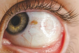 Snapshot of an eye.